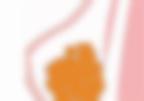 身体肥胖可以抽脂吗——美丽与健康的平衡之道