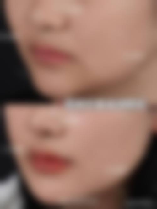 陕西新素原美医疗美容怎么样？口碑好不好