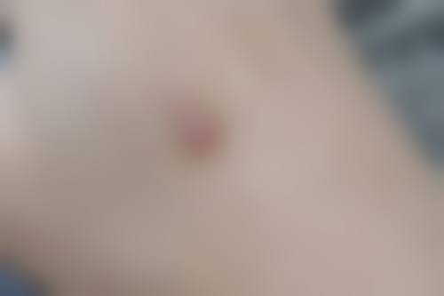 惠州芝华整形医院项目特色