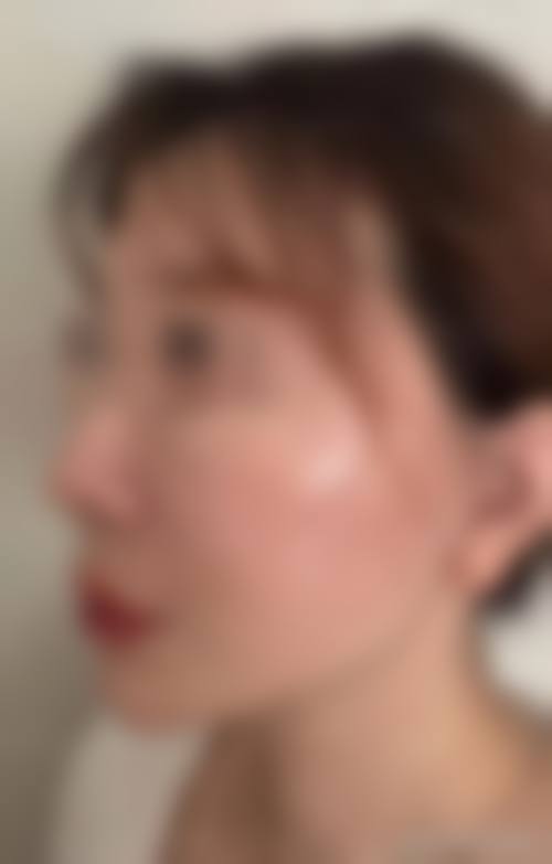 邵阳华美医疗美容医院怎么样，口碑评价如何？