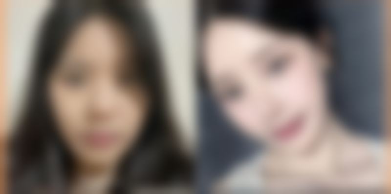 怎么修复外伤疤痕成效好：应急处理关键多