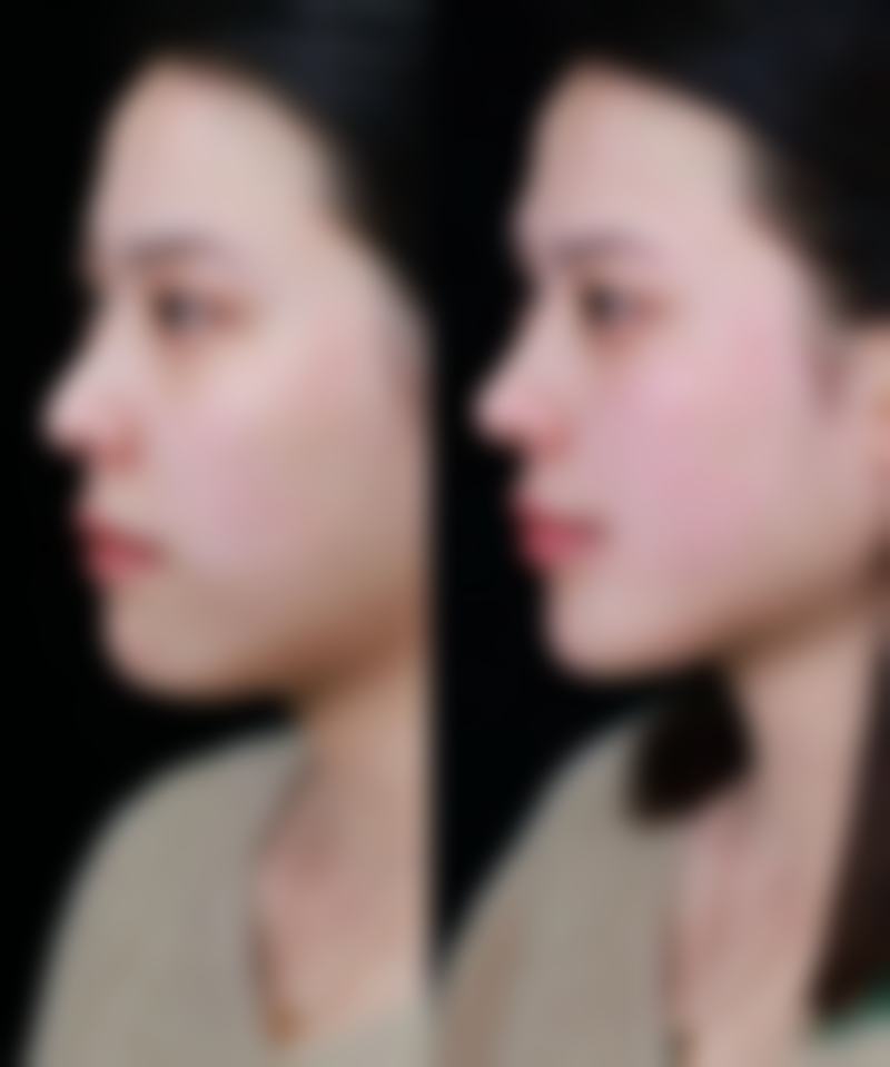 陕西新素原美医疗美容怎么样？是否正规