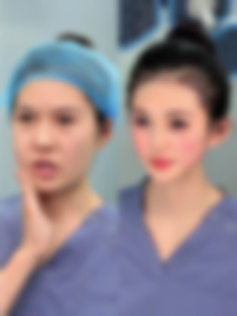 身体肥胖可以抽脂吗——老年肥胖抽脂的风险考量