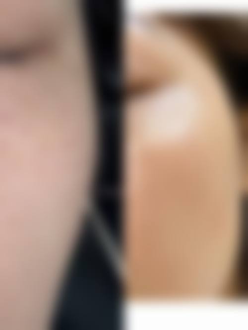 扬州俏华美医疗美容诊所高军飞医生价目表2026——扬州明康眼科医院