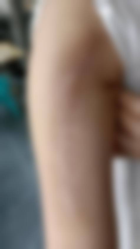 韩国首尔友珍整形外科医院价格表