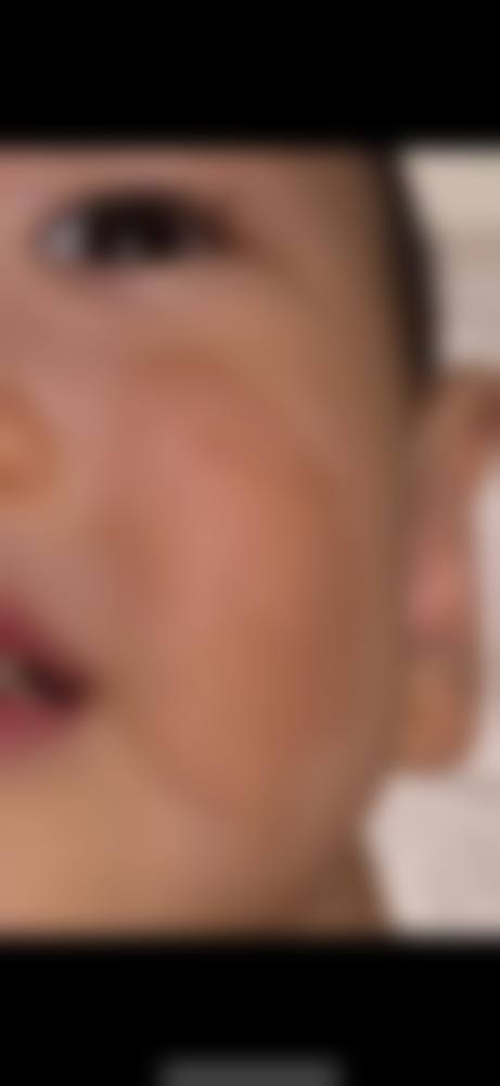 郑盛宇医生简介项目优势