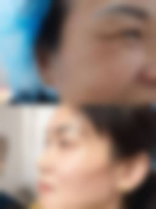 菏泽丽雅医疗美容门诊部怎么样，价格表如何