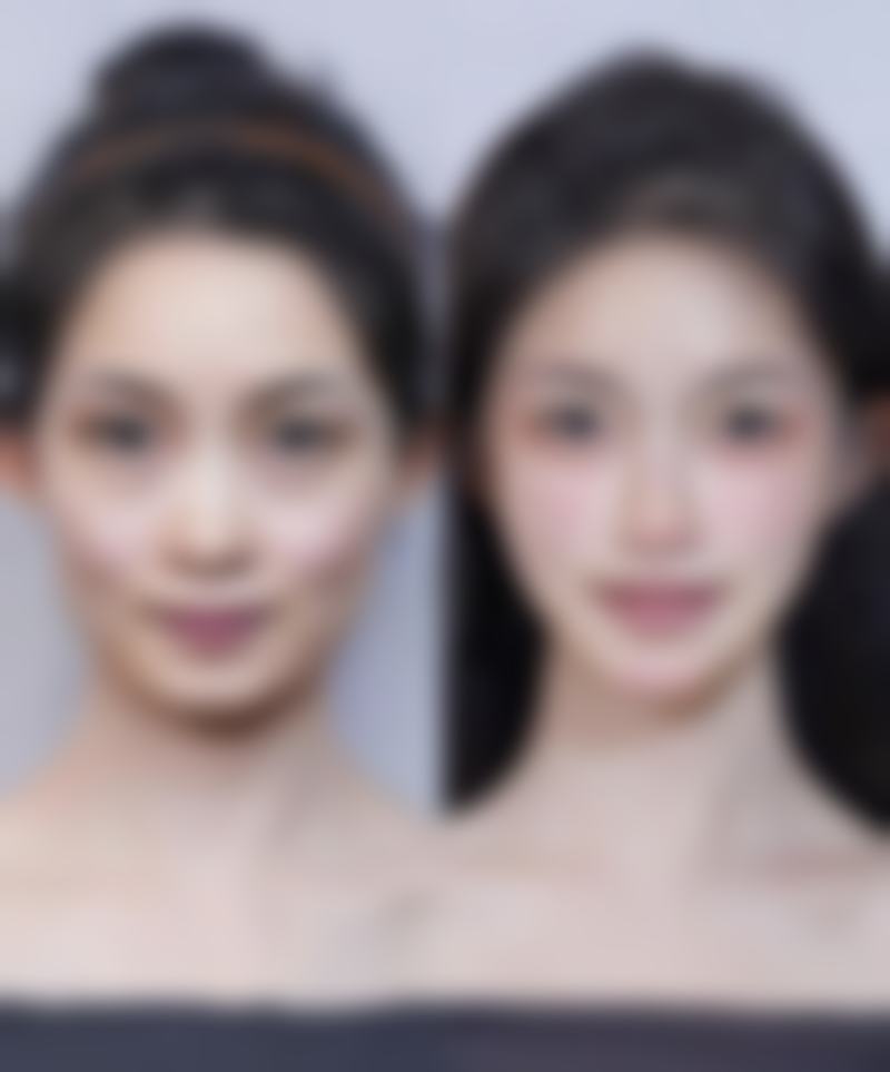 结语：告别疤痕阴影，拥抱精彩人生