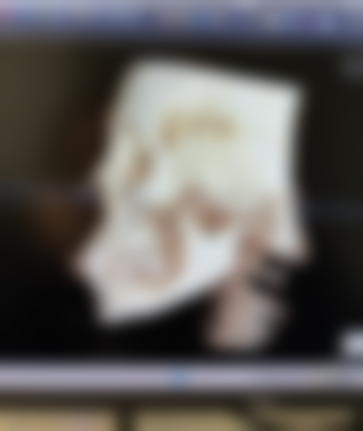 三等甲医院激光祛疤的设备与骨干医生优势显著