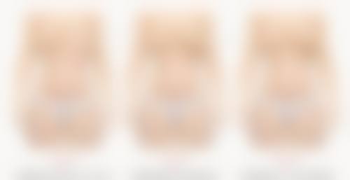 割平行双眼皮多久可以翻白眼：时尚眼型的修复要点