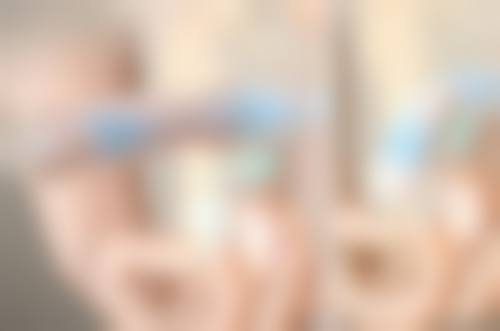 全切双眼皮切眼袋消肿之手术方式影响