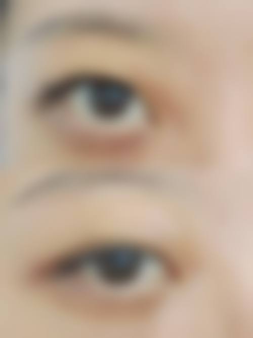 广州蒂伊医疗美容门诊部价格表