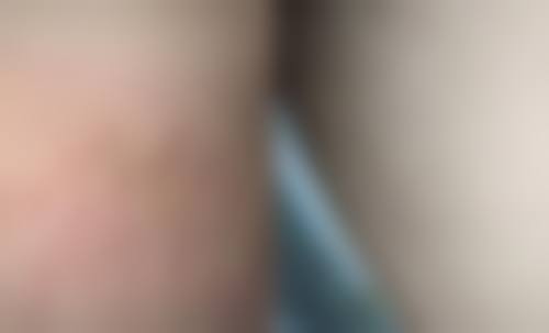 河南郑州美辰整形医疗美容口碑好不好