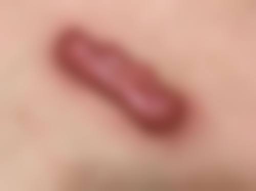 淮南东方医院集团谢一医院怎么样，口碑评价如何