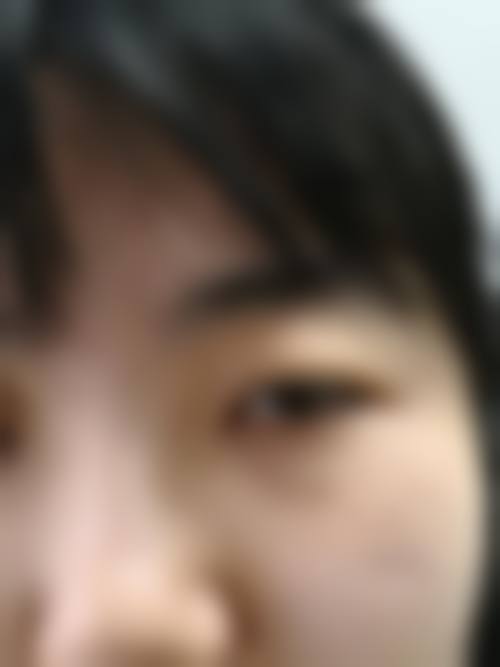 监利白衣天使医疗美容诊所更擅长什么手术