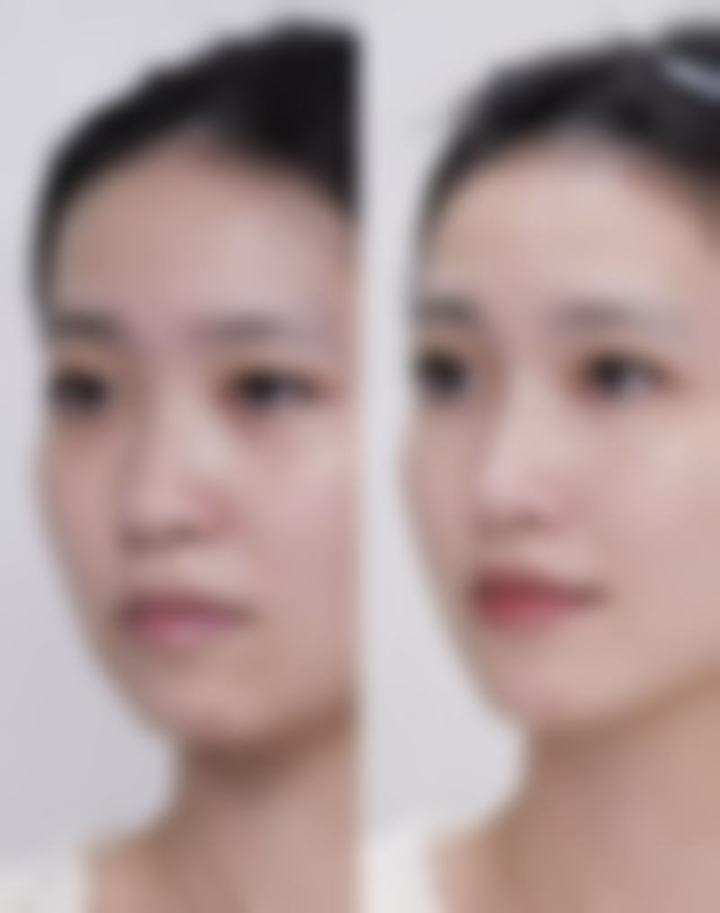 聊城中医院整形美容中 心口碑好不好