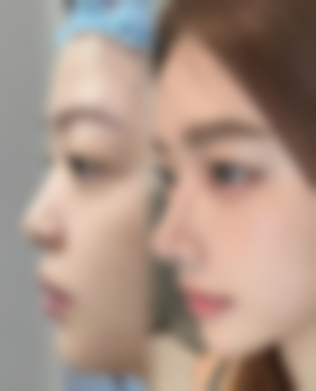 杭州悦可医疗美容诊所邹霞属于骨干医生还是普通医生——重庆现代女子医院整形美容科