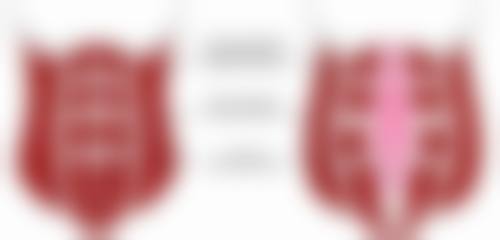 刘和平医生简介做手术价格