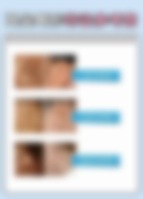 刘广栋医生顾客实例图片