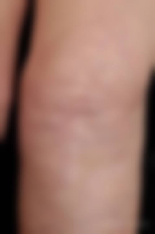 刘广栋医生项目优势