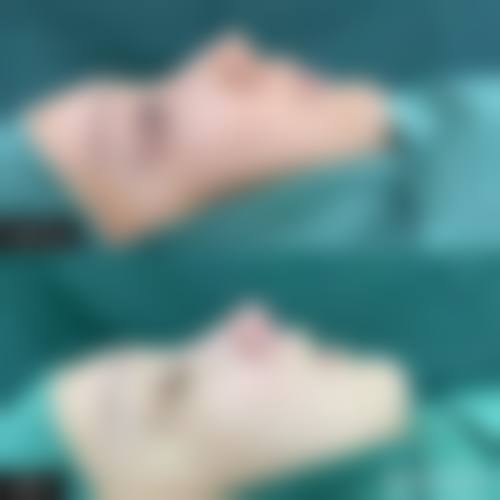 汕尾市逸挥基金医院价格表