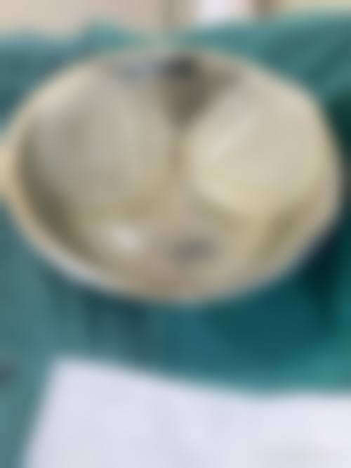 南京市第二医院(整形外科)项目特色