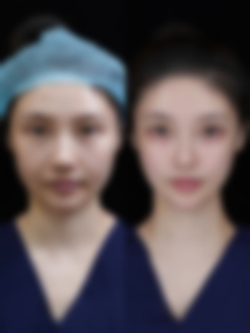 如何才能消掉疤痕体质之中医调理：医院参考的古老智慧助力