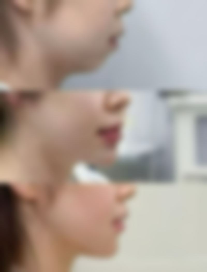 如何才能消掉疤痕体质之饮食调理：医院认可的吃出好皮肤秘诀