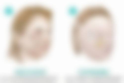 影响硅胶隆胸后哺乳的因素——全方面了解，心中有数