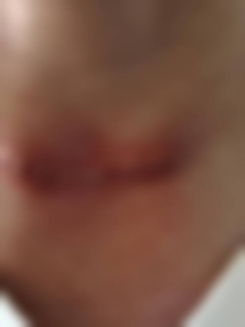 七、宁波同仁妇科医院整形美容科口碑好不好怎么样？附真实患者口碑评价