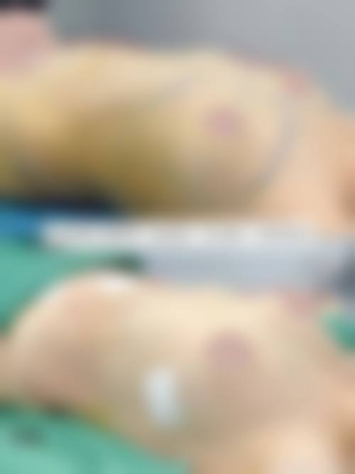 广州天姿医学整形美容门诊部价格表