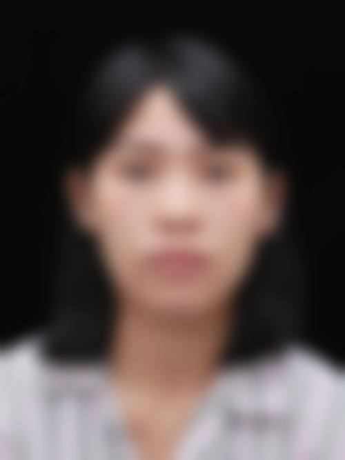 济南悦荟医疗美容门诊部顾客实例