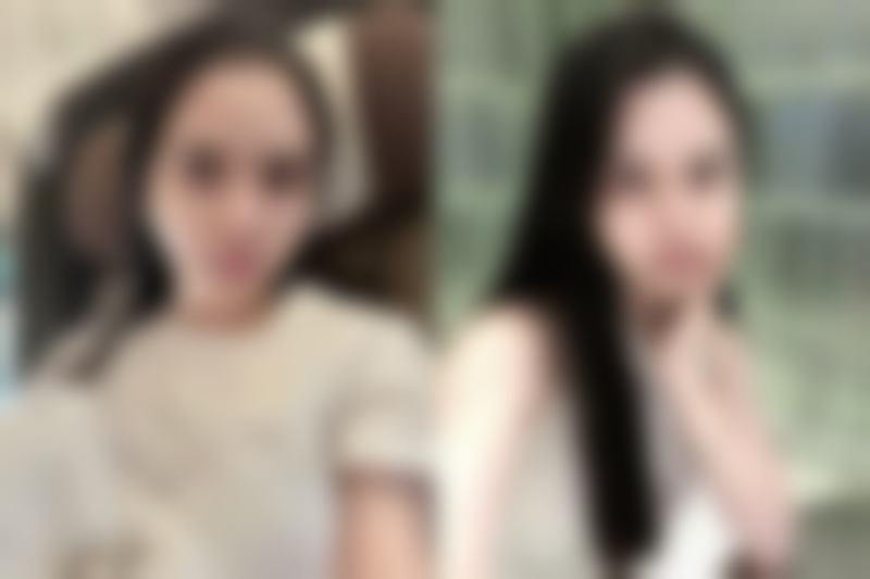 丰太阳穴怎样是比较安心的：术前检查的重要防线