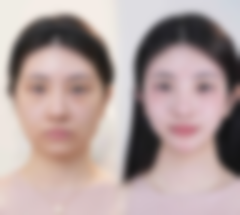 鄂尔多斯伊美尔医学美容诊所更擅长什么手术