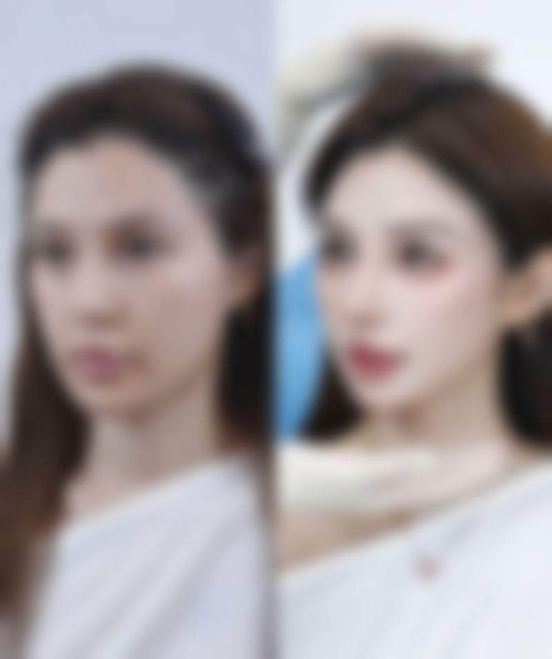 20年的手术疤痕怎么消除？医院科学策略见成效