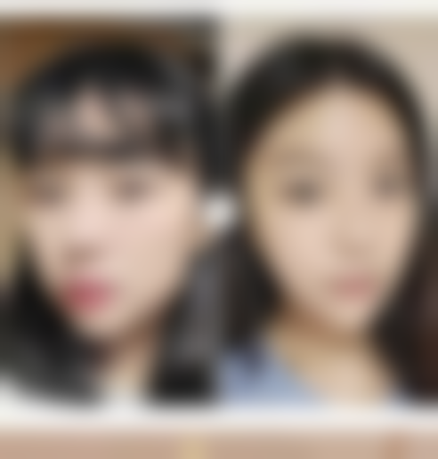 痘痘留下的疤痕怎么办：药物修复，温和有效的“居家方案”