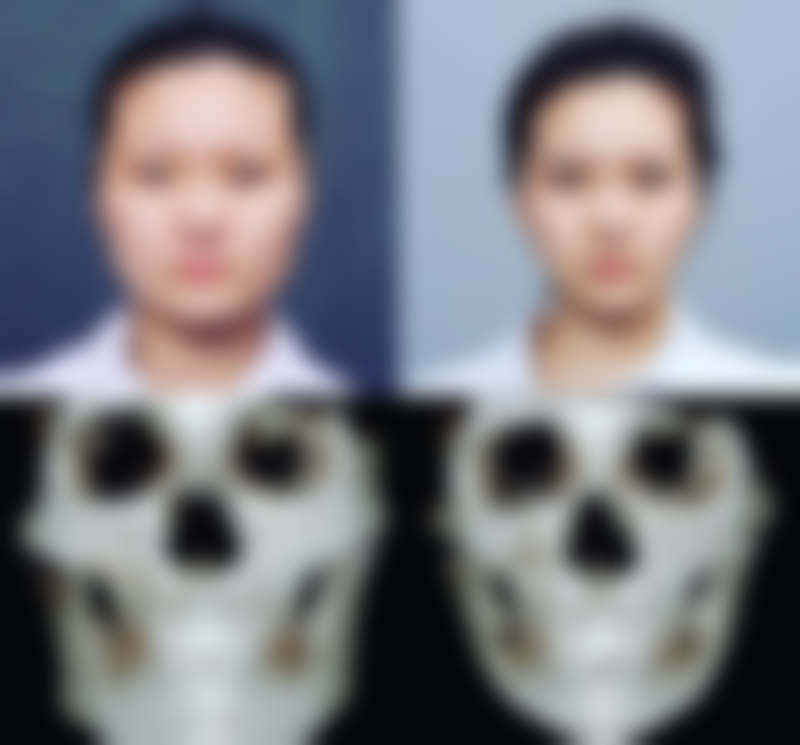 南昌美皇医疗美容门诊部顾客实例