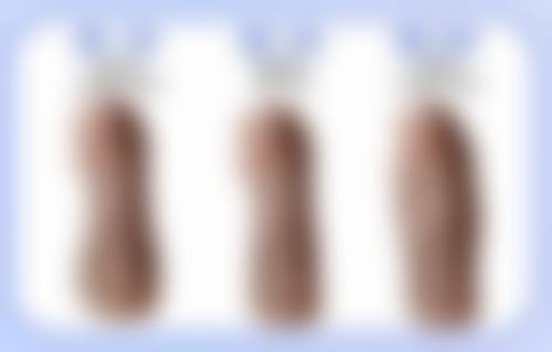 压的双眼皮太宽改窄的费用详情