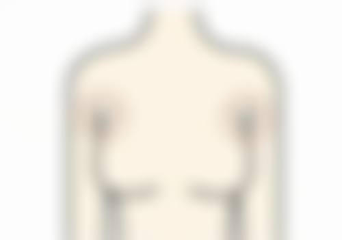 婴儿烫伤疤痕增生多久消除：不同年龄段婴儿的修复差异