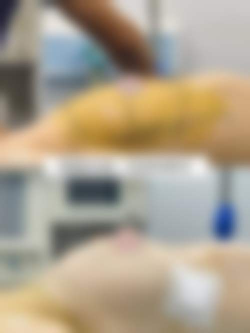 叶春伙医生做手术价格