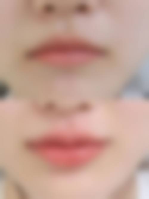 成都武侯菲格整形医疗美容医院口碑评价如何