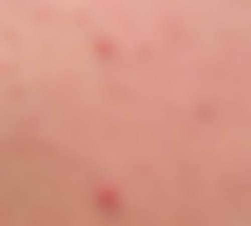 武汉德恩医疗美容医院价格表