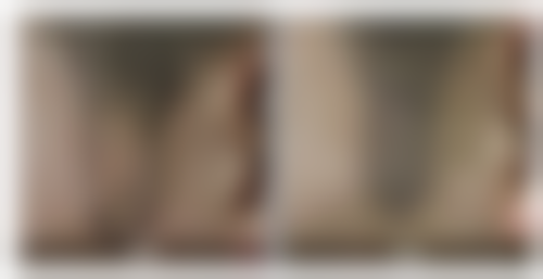 叶春伙医生口碑如何