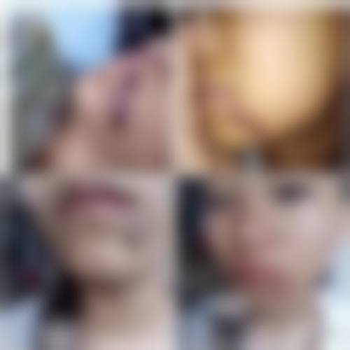 刘静虹医生简介之项目优势