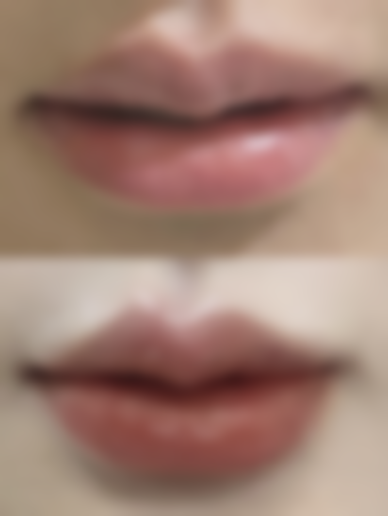 山东省立医院强调日常护理辅助作用