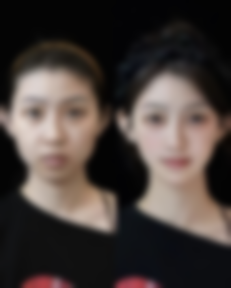 年龄对修复的影响