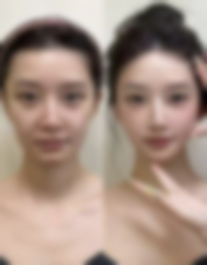 杨伟佳医生简介项目优势