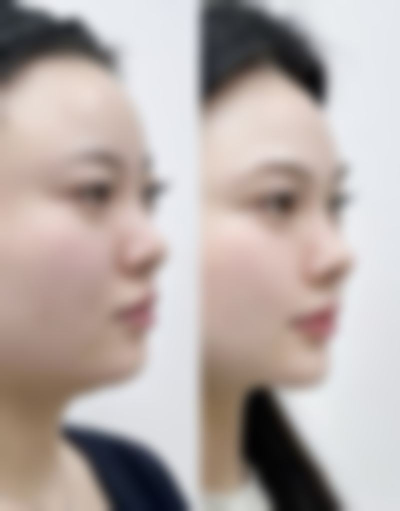 胡丹医生简介做手术价格