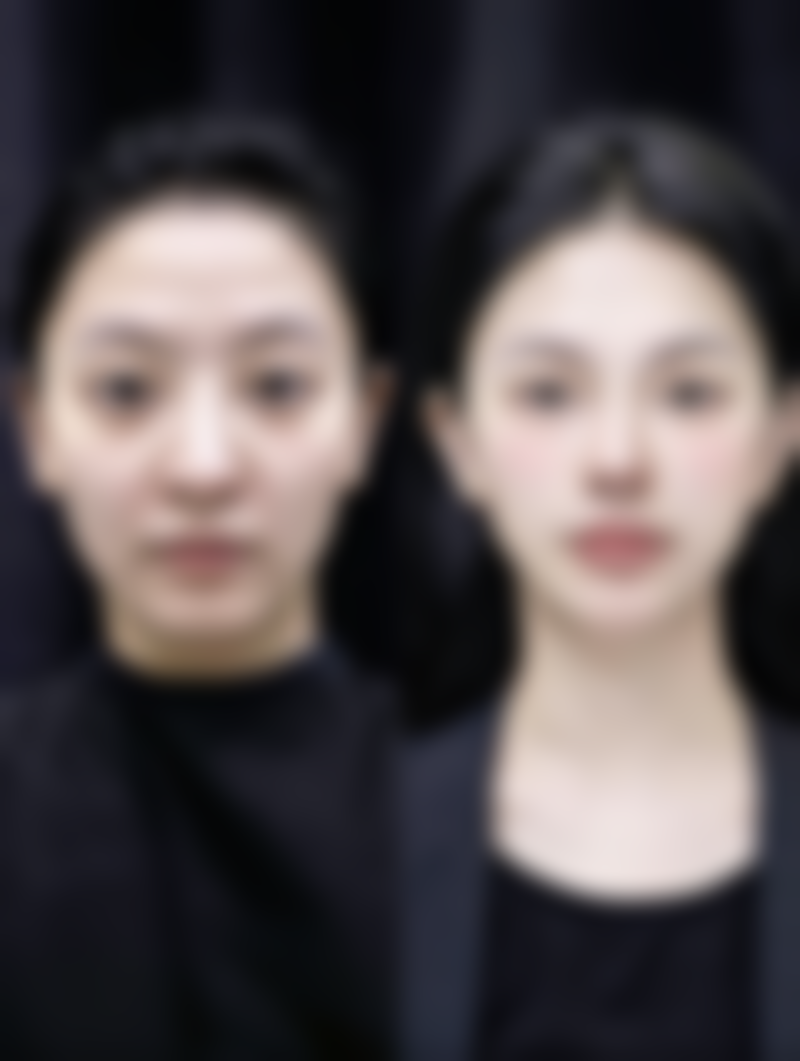 杨伟佳医生简介做手术价格