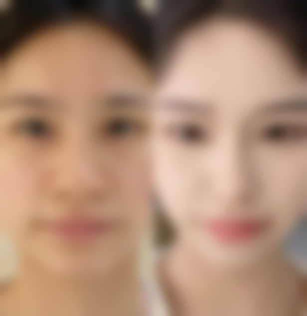 北京大学人民医院提醒修复手术风险与注意事项